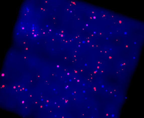 NASA APOD August 14, 2001: X-Rays from the Galactic Plane