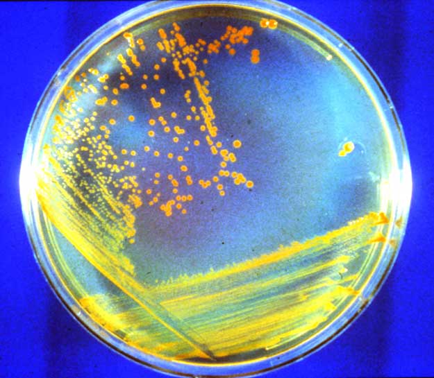 APOD: D. rad Bacteria: Candidate Astronauts - January 22, 2006