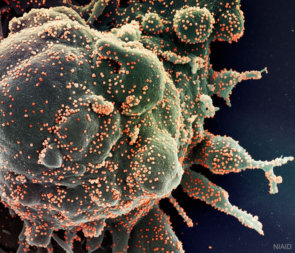 APOD: Novel Coronavirus Attacks Humanity - June 2, 2020