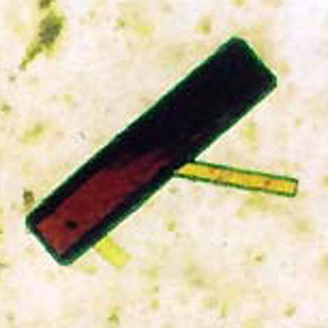 Microgravity