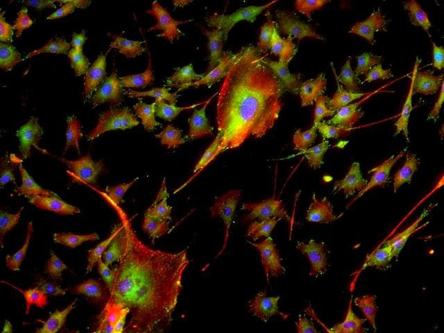 NASA image: Skeletal muscle cells cultured on Earth