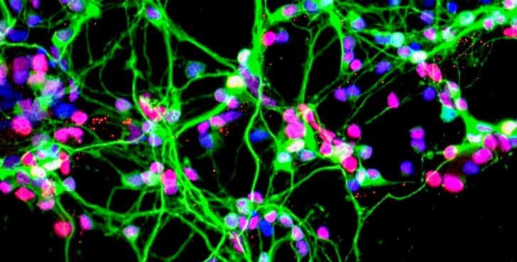 NASA image: Dopaminergic neurons growing in a culture dish (20x magnificatio