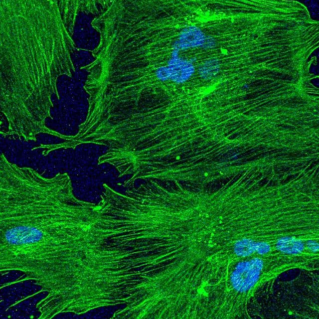 NASA image: Immunosenescence