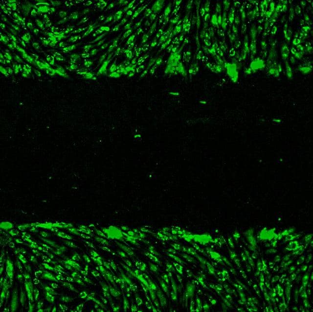 NASA image: Immunosenescence