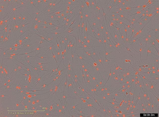 NASA image: PRO Imagery Submittal - Microgravity Associated Bone Loss-B (MABL-B)