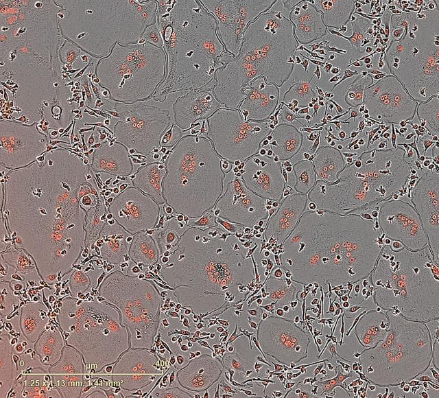 NASA image: PRO Imagery Submittal - Microgravity Associated Bone Loss-B (MABL-B)